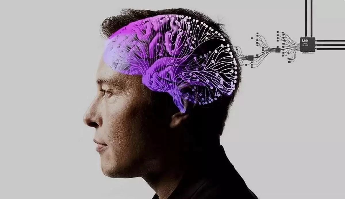 Neuralink, Kanada’da beyin çipini test etme izni aldı